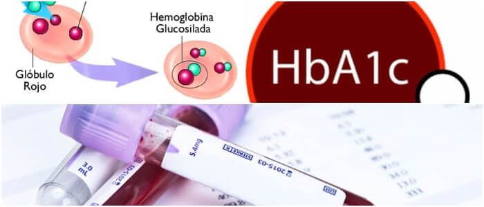 La Prueba De Hemoglobina Glicosilada Y Su Importancia En El Tratamiento Porn Sex Picture 7839