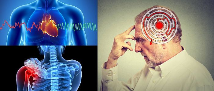 la hiperhomocisteinemia y el acido folico