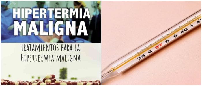 hipertermia maligna tratamiento pdf
