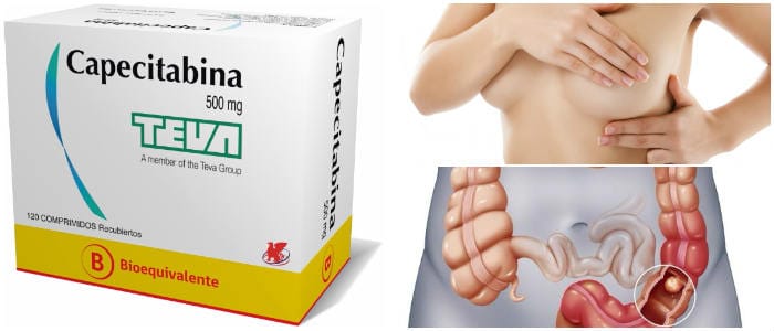 cual es el tratamiento con capecitabina para el cáncer de colon