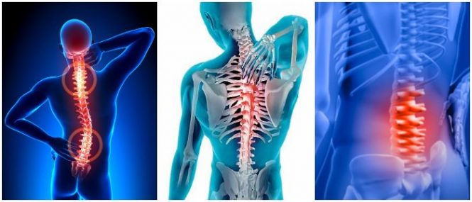 Cuatro herramientas que debe tener para Ejercicios para dolor de espalda