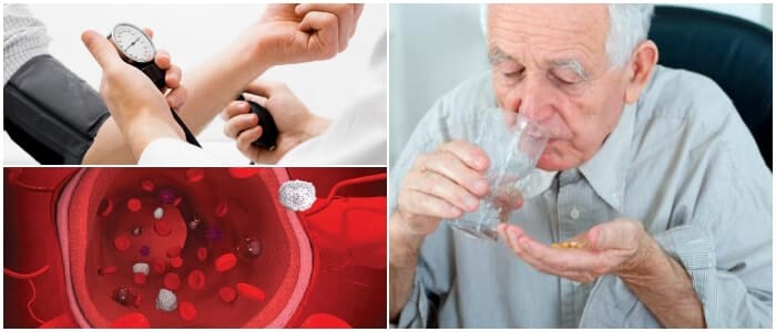 cuales son las contraindicaciones de la indapamida