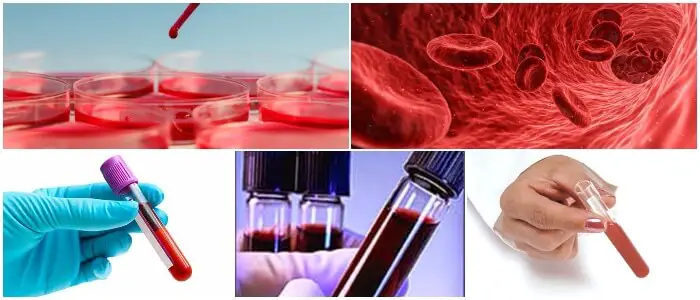 consecuencias del plomo en la sangre de un bebe