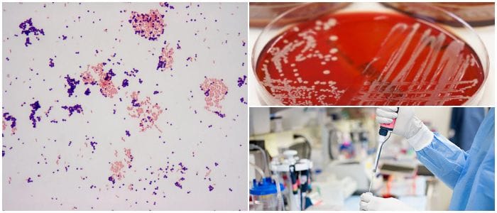 articulos cientificos de la tincion de gram