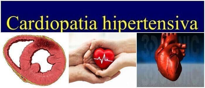 Cardiopatía Hipertensiva Características Síntomas Causas Diagnóstico Prevención