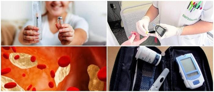 cual es la bioquímica de los cuerpo cetonico