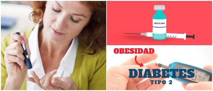 diabetes tipo 2 causas dieta tratamiento y consecuencias