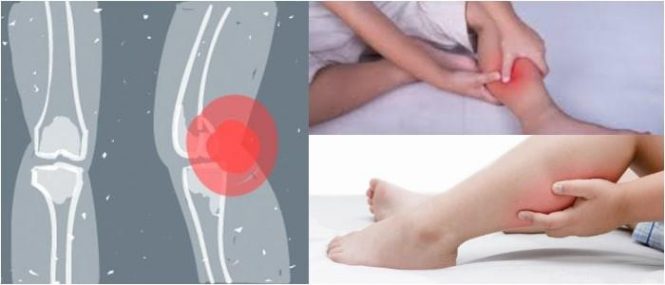 cual es la frecuencia del dolor de piernas en niños al dormir