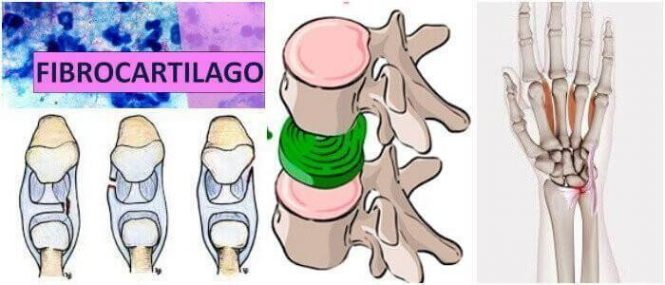 que es el fibrocartilago triangular