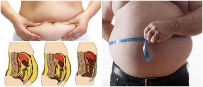 causas de la grasa abdominal