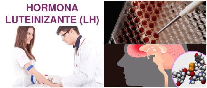 cual es el significado de la hormona lh alta