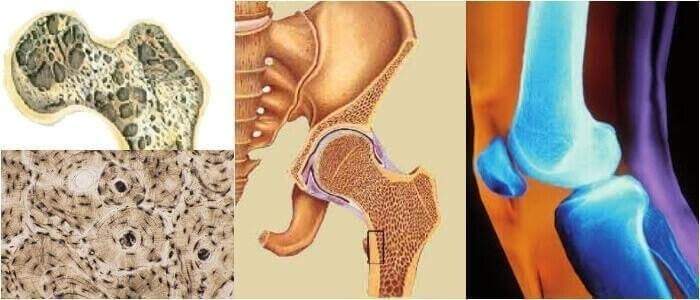 que es un osteona cortical