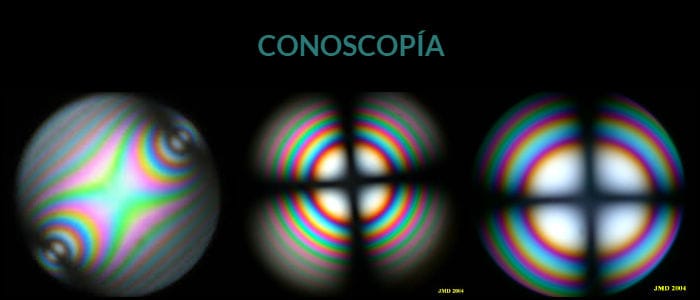 la conoscopía se realiza con un conoscopio