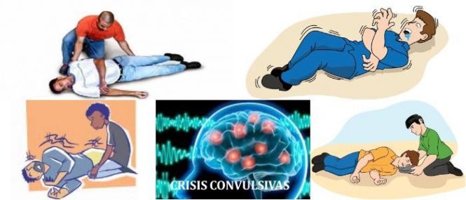 Puede encontrarse después de una crisis convulsiva, un accidente cerebrovascular o un trauma craneoencefálico. Se observa tam