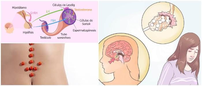 que es la hormona folículo estimulante baja