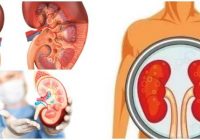 cuales son los síntomas de uremia alta