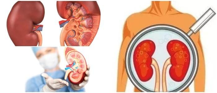 cuales son los síntomas de uremia alta