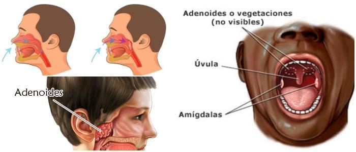 cual es la anatomía de las adenoides