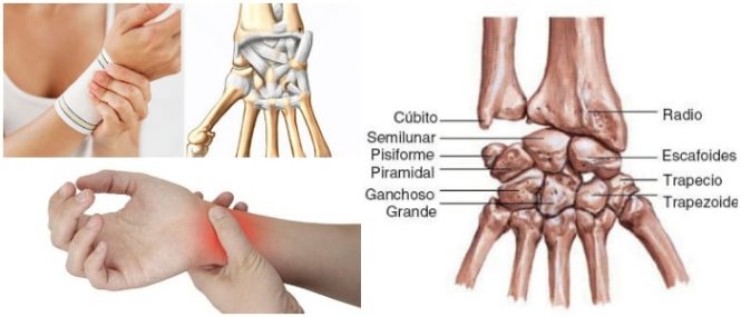 articulación de la muñeca ligamentos