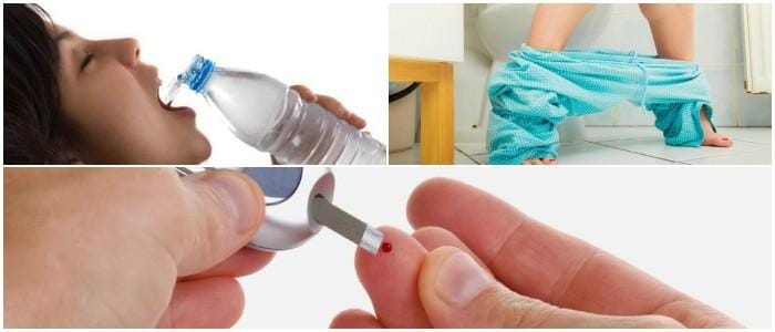 cuales son los síntomas de la diabetes insípida