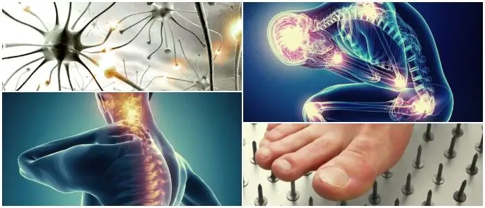 cual es el diagnóstico del dolor neuropático