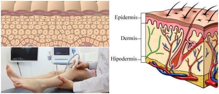 cual es la definición de epidermis