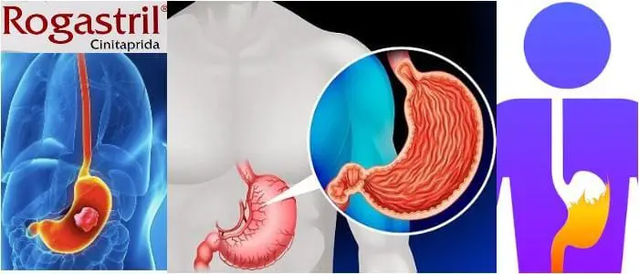 cual es la acción farmacológica delrogastril