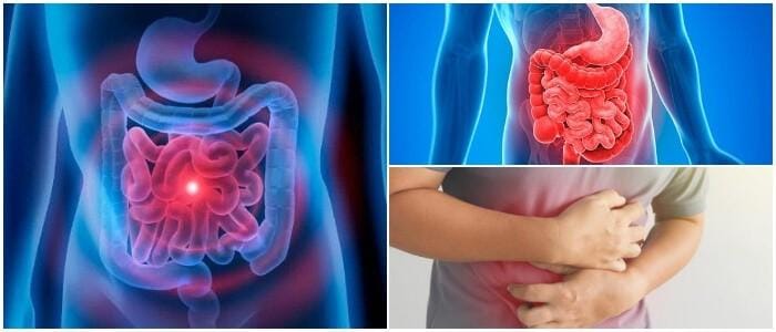 cual es el tratamiento del sangrado del tubo digestivo