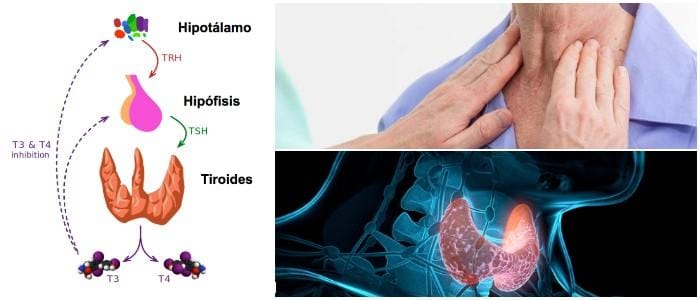 cual es la enfermedad relacionada con la ths