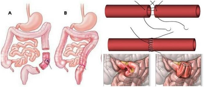 cual es la anatomía de la anastomosis