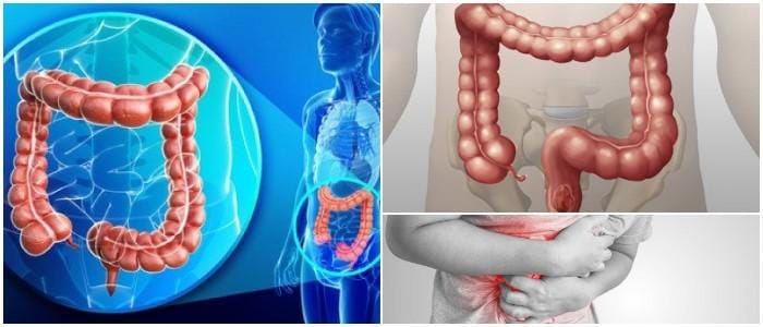 que es el colon ascendente