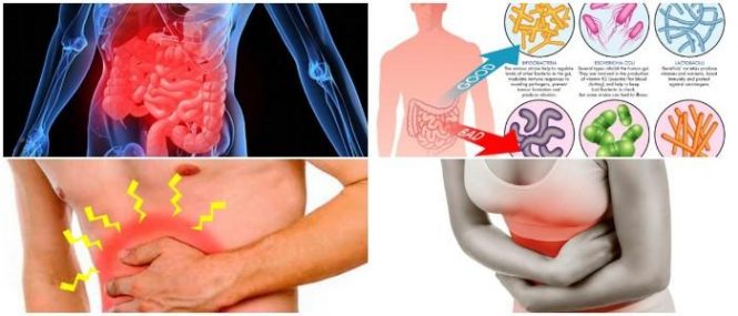 cuales son las consecuencias de la gastroenteritis aguda