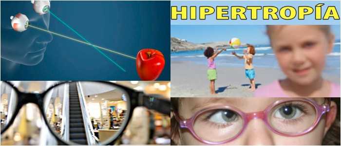 que es la hipertrofia de ojo