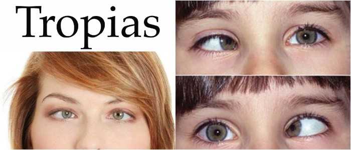 que son las tropias y forias