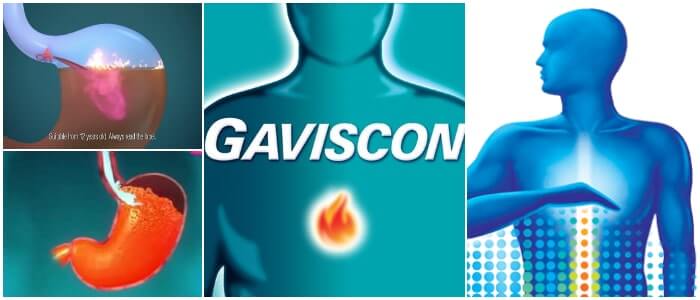 como se toma el gaviscon