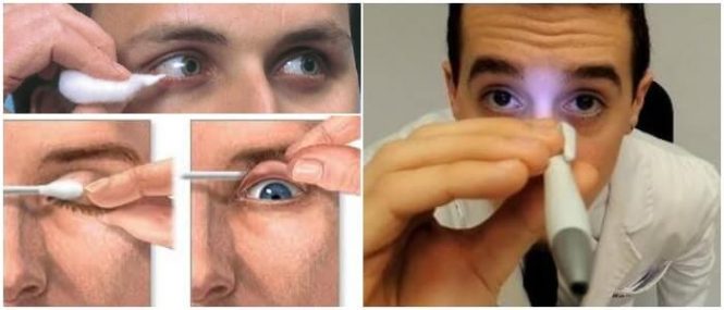 como se realiza el reflejo corneal