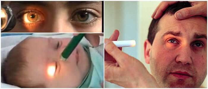 cual es el concepto de reflejo palpebral