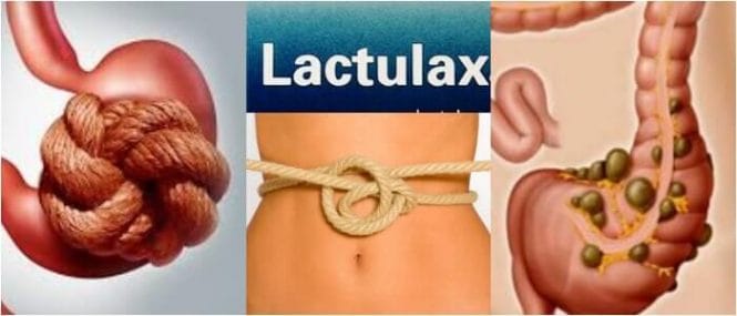 como es la administración de lactulax