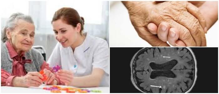 infartos cerebrales