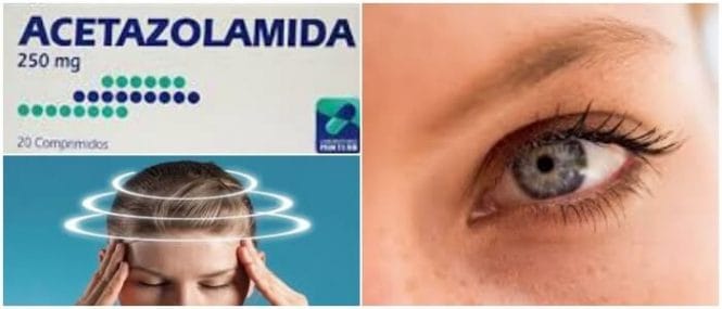 inhibidor de la enzima anhidrasa carbónica