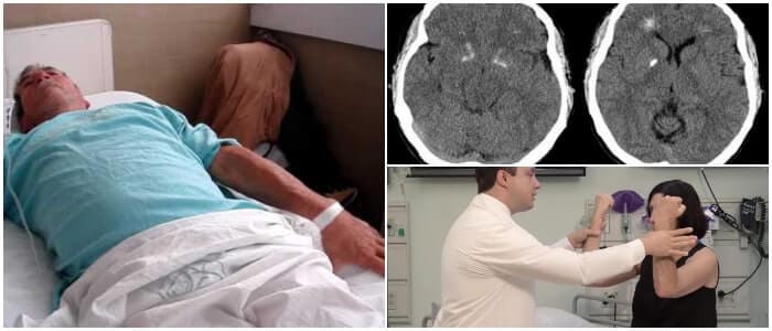 movimientos involuntarios